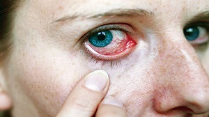 مواد آرایشی حساسیت چشم را بیشتر می‌کنند