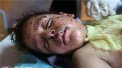 شهادت ۵ فلسطینی در بمباران شمال نوار غزه